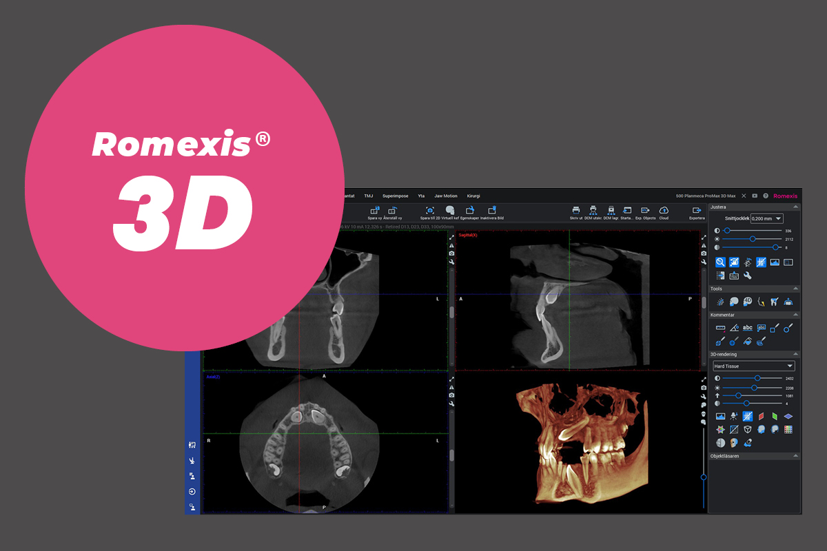 romexis-6-3D-teaser-3x2.jpg